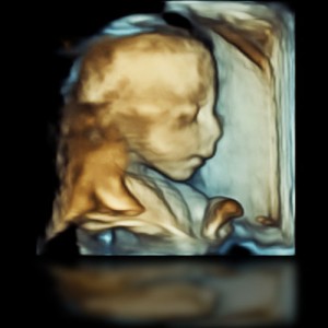3D-Ultraschall-BabyFlash
