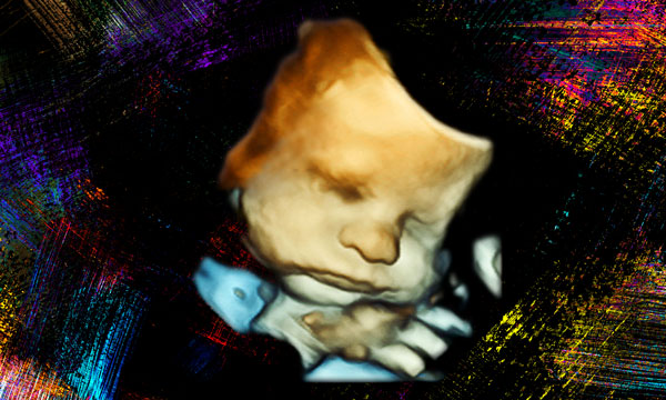 Leinwand_3D Ultraschall BabyFlash
