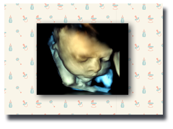 3D Ultraschall BabyFlash