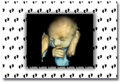 3D Ultraschall BabyFlash